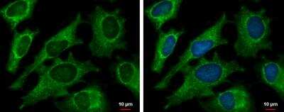 Immunocytochemistry/ Immunofluorescence: DECR1 Antibody [NBP1-33103]