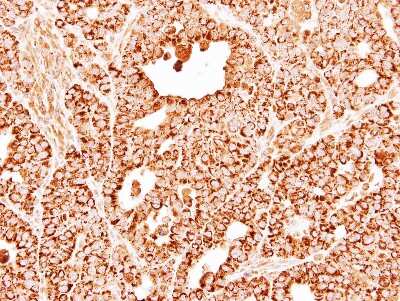Immunohistochemistry-Paraffin: DECR1 Antibody [NBP1-33103]