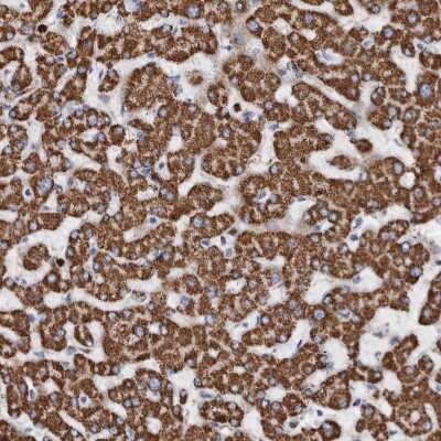 Immunohistochemistry-Paraffin: DECR1 Antibody [NBP1-85263]