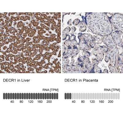 Immunohistochemistry-Paraffin: DECR1 Antibody [NBP1-85263]