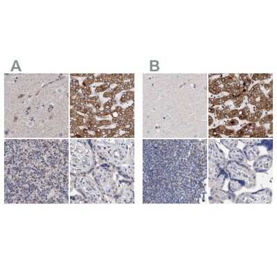 Immunohistochemistry-Paraffin: DECR1 Antibody [NBP1-85263]