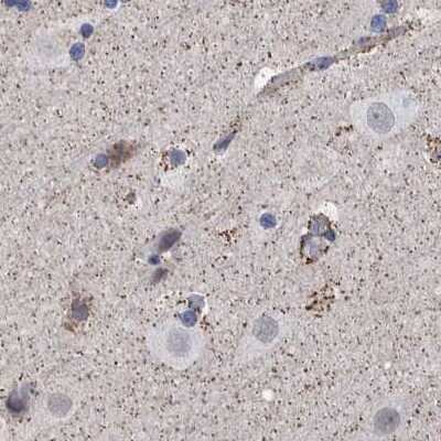 Immunohistochemistry-Paraffin: DECR1 Antibody [NBP1-85263]