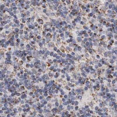 Immunohistochemistry-Paraffin: DECR1 Antibody [NBP1-85263]
