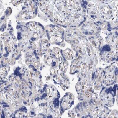 Immunohistochemistry-Paraffin: DECR1 Antibody [NBP1-85264]