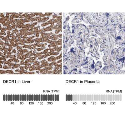 Immunohistochemistry-Paraffin: DECR1 Antibody [NBP1-85264]
