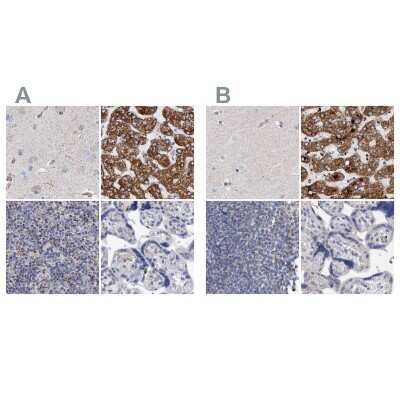 Immunohistochemistry-Paraffin: DECR1 Antibody [NBP1-85264]