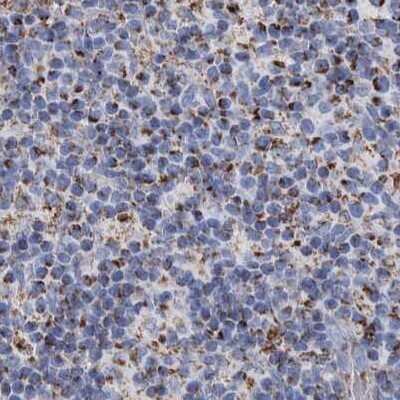 Immunohistochemistry-Paraffin: DECR1 Antibody [NBP1-85264]