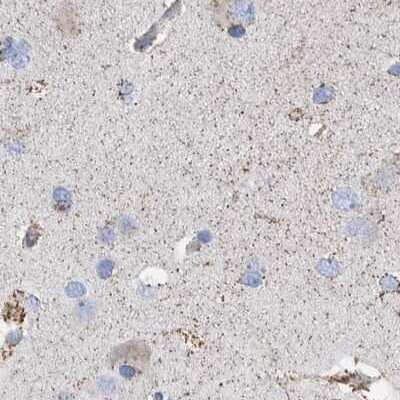 Immunohistochemistry-Paraffin: DECR1 Antibody [NBP1-85264]