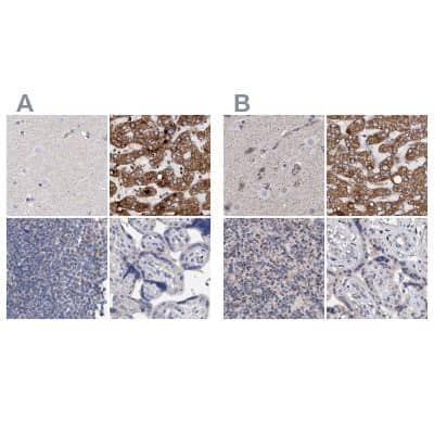 Immunohistochemistry-Paraffin: DECR1 Antibody [NBP1-85265]