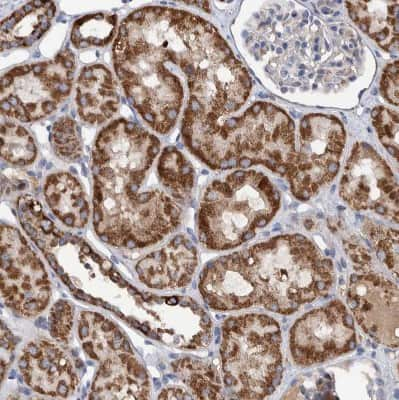 Immunohistochemistry-Paraffin: DECR1 Antibody [NBP1-85265]