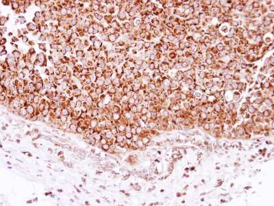 Immunohistochemistry-Paraffin: DECR1 Antibody [NBP2-16144]