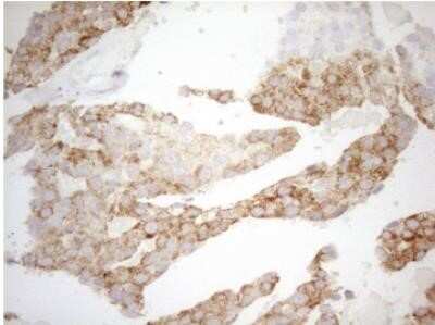 Immunohistochemistry: DECR1 Antibody (OTI4G4) - Azide and BSA Free [NBP2-70564]