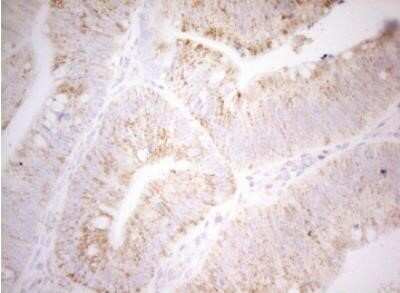 Immunohistochemistry: DECR1 Antibody (OTI4G4) - Azide and BSA Free [NBP2-70564]