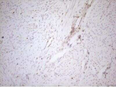 Immunohistochemistry: DECR1 Antibody (OTI4G4) - Azide and BSA Free [NBP2-70564]