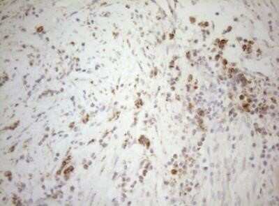 Immunohistochemistry: DECR1 Antibody (OTI4G4) - Azide and BSA Free [NBP2-70564]