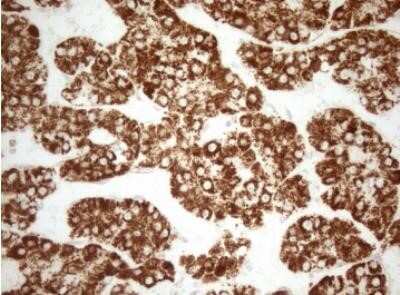 Immunohistochemistry: DECR1 Antibody (OTI4G4) - Azide and BSA Free [NBP2-70564]