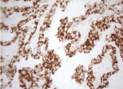 Immunohistochemistry: DECR1 Antibody (OTI4G4) - Azide and BSA Free [NBP2-70564]