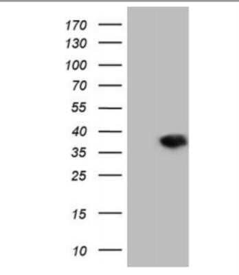 Western Blot: DECR1 Antibody (OTI4G4)Azide and BSA Free [NBP2-70564]