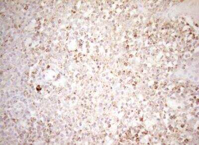 Immunohistochemistry-Paraffin: DECR1 Antibody (OTI4G4) [NBP2-46449]