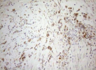 Immunohistochemistry-Paraffin: DECR1 Antibody (OTI4G4) [NBP2-46449]