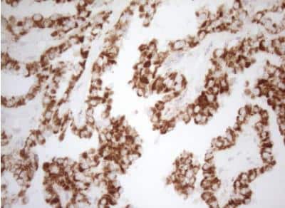 Immunohistochemistry-Paraffin: DECR1 Antibody (OTI4G4) [NBP2-46449]