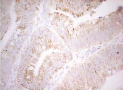 Immunohistochemistry-Paraffin: DECR1 Antibody (OTI4G4) [NBP2-46449]