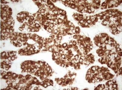 Immunohistochemistry-Paraffin: DECR1 Antibody (OTI4G4) [NBP2-46449]