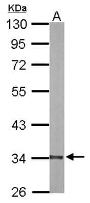 Western Blot: DECR1 Antibody [NBP1-33103]