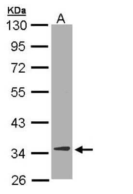Western Blot: DECR1 Antibody [NBP1-33103]