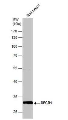 Western Blot: DECR1 Antibody [NBP1-33103]