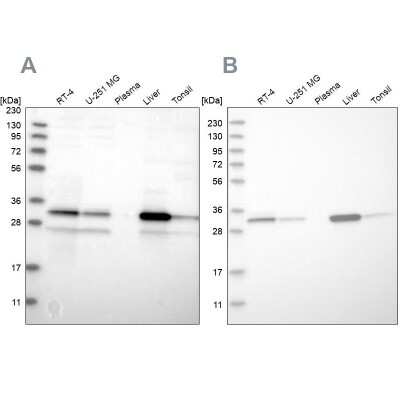 Western Blot: DECR1 Antibody [NBP1-85263]