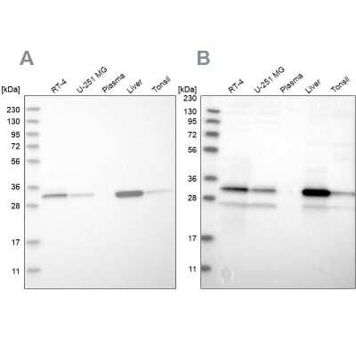 Western Blot: DECR1 Antibody [NBP1-85264]