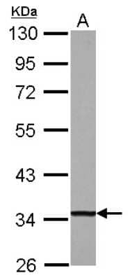 Western Blot: DECR1 Antibody [NBP2-16144]