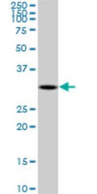 Western Blot: DECR2 Antibody (4A7) [H00026063-M03]