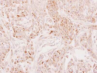Immunohistochemistry-Paraffin: DECR2 Antibody [NBP2-16145]
