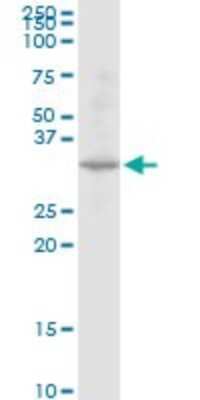 Western Blot: DECR2 Antibody [H00026063-B01P]