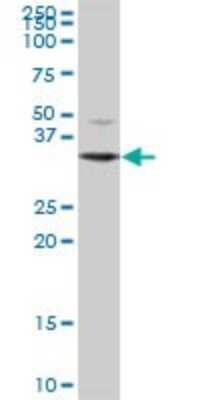 Western Blot: DECR2 Antibody [H00026063-B01P]