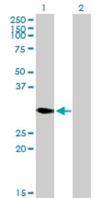 Western Blot: DECR2 Antibody [H00026063-B01P]