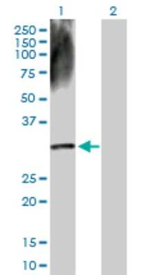 Western Blot: DECR2 Antibody [H00026063-D01P]