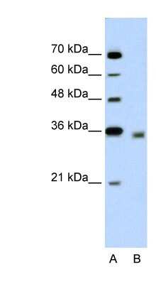 Western Blot: DECR2 Antibody [NBP1-53172]