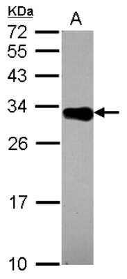 Western Blot: DECR2 Antibody [NBP2-16145]