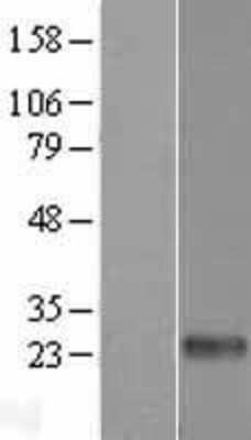 Western Blot: Dectin-2/CLEC6A Overexpression Lysate [NBP2-10762]