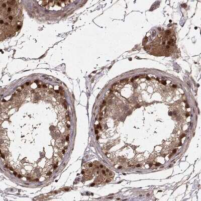 Immunohistochemistry: DEDD Antibody [NBP2-68959]