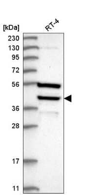 Western Blot: DEDD Antibody [NBP2-76527]