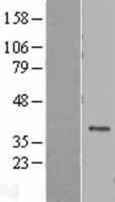 Western Blot: DEDD Overexpression Lysate [NBL1-09814]