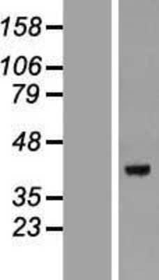 Western Blot: DEDD Overexpression Lysate [NBP2-09207]