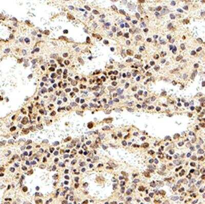 Immunohistochemistry-Paraffin: DEDD2 Antibody [NB100-56137]