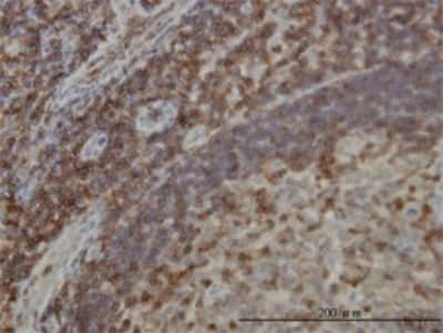 Immunohistochemistry-Paraffin: DEF6 Antibody (1F2) [H00050619-M01]