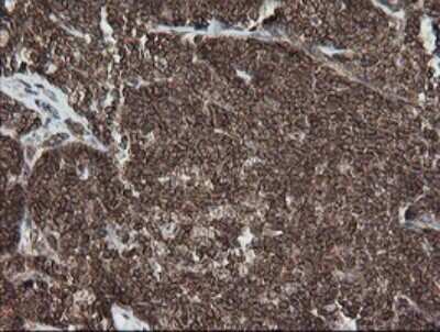 Immunohistochemistry: DEF6 Antibody (OTI3F9) [NBP2-46456]