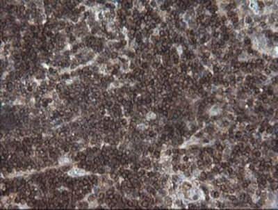 Immunohistochemistry: DEF6 Antibody (OTI3F9) [NBP2-46456]